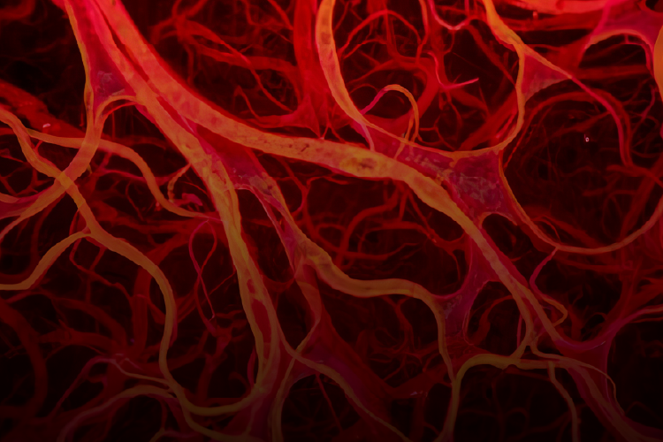 Estenosis aórtica severa asintomática: decisión terapéutica